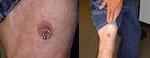nip_leglegnipple.jpg